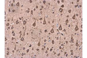 IHC-P Image BACE1 antibody [N1C2] detects BACE1 protein at cytoplasm in Rat brain by immunohistochemical analysis. (BACE1 抗体)