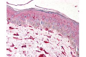 Anti-Vimentin antibody IHC of human skin. (Vimentin 抗体)