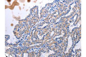 Immunohistochemistry (IHC) image for anti-Urotensin 2 (UTS2) antibody (ABIN5547204) (Urotensin 2 抗体)