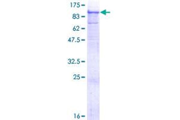 ADAM12 Protein (AA 1-737) (GST tag)