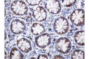 Image no. 2 for anti-Mast/stem Cell Growth Factor Receptor (KIT) (AA 546-976) antibody (ABIN1491586) (KIT 抗体  (AA 546-976))