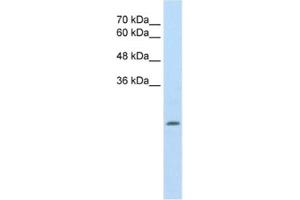 Western Blotting (WB) image for anti-Aldehyde Dehydrogenase 4 Family, Member A1 (ALDH4A1) antibody (ABIN2462883) (ALDH4A1 抗体)