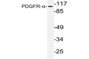 Western blot (WB) analysis of PDGFR-alpha antibody in extracts from Jurkat cells. (PDGFRA 抗体)