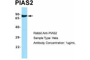 Host:  Rabbit  Target Name:  PIAS2  Sample Type:  Hela  Antibody Dilution:  1. (PIAS2 抗体  (C-Term))