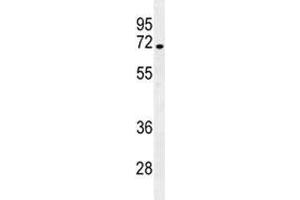 NUMB antibody western blot analysis in NCI-H292 lysate. (NUMB 抗体  (AA 1-30))