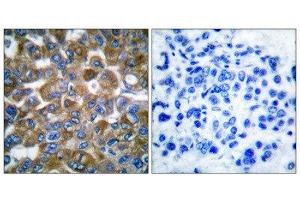 Immunohistochemistry (IHC) image for anti-Keratin 15 (KRT15) (N-Term) antibody (ABIN1848626) (KRT15 抗体  (N-Term))