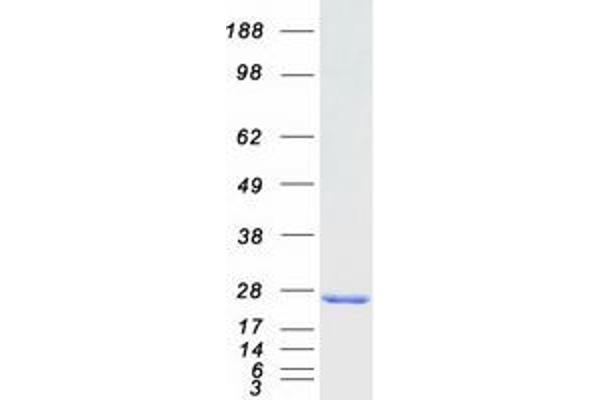 RAB9A Protein (Myc-DYKDDDDK Tag)