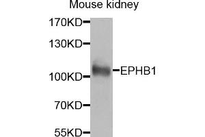 Western blot analysis of extracts of mouse kidney, using EPHB1 antibody (ABIN5974587) at 1/1000 dilution. (EPH Receptor B1 抗体)