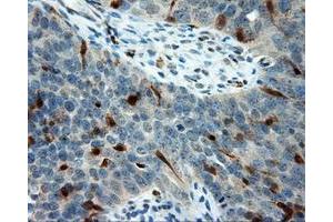 Immunohistochemical staining of paraffin-embedded Kidney tissue using anti-LIPG mouse monoclonal antibody. (LIPG 抗体)