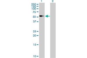 Western Blot analysis of CD86 expression in transfected 293T cell line by CD86 MaxPab polyclonal antibody. (CD86 抗体  (AA 1-329))