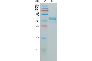 GNRHR Protein (AA 1-38) (Fc Tag)