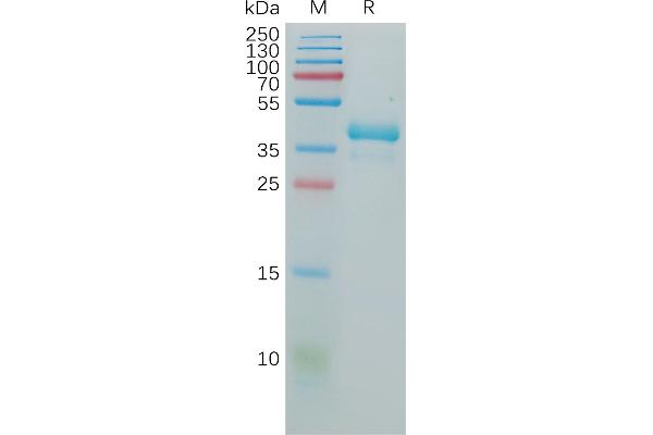 GNRHR Protein (AA 1-38) (Fc Tag)