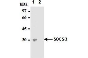 Immunoprecipitation of SOCS-3 from mouse hepatocytes with AM26562AF-N  or mouse IgG1  After immunoprecipitated with the antibody, immunocomplex was resolved on SDS-PAGE and immunoblotted with biotinylated anti-SOCS-3 monoclonal antibody. (SOCS3 抗体  (AA 2-44))