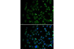 Immunofluorescence analysis of U2OS cell using MAP2K1 antibody. (MEK1 抗体)