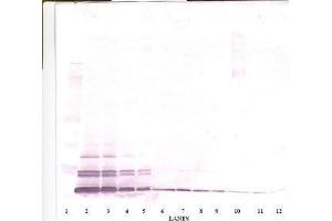 Image no. 1 for anti-Chemokine (C-C Motif) Ligand 26 (CCL26) antibody (ABIN465091) (CCL26 抗体)