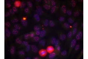Immunofluorescence staining of methanol-fixed HeLa cells using Elk-1 (phospho-Thr417) antibody (E011038, Red) (ELK1 抗体  (pThr417))