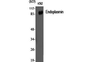 Western Blotting (WB) image for anti-Heat Shock Protein 90kDa beta (Grp94), Member 1 (HSP90B1) antibody (ABIN5959523) (GRP94 抗体)