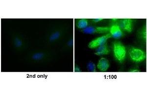 Immunofluorescence (Cultured Cells) (IF (cc)) image for anti-Vimentin (VIM) (AA 371-466) antibody (ABIN672786)