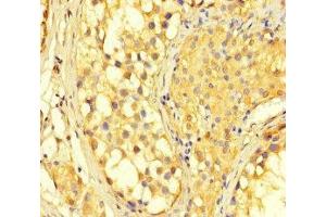 Immunohistochemistry of paraffin-embedded human testis tissue using ABIN7150987 at dilution of 1:100 (RNF2 抗体  (AA 1-100))
