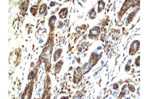 Immunohistochemistry (IHC) image for anti-V-Raf-1 Murine Leukemia Viral Oncogene Homolog 1 (RAF1) (AA 31-130) antibody (ABIN733208)