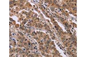 Immunohistochemistry (IHC) image for anti-Family with Sequence Similarity 3, Member B (FAM3B) antibody (ABIN2423425) (FAM3B 抗体)