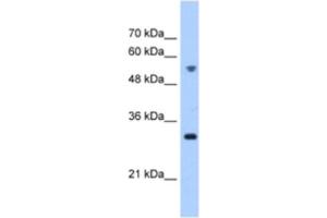 Western Blotting (WB) image for anti-Tetratricopeptide Repeat Domain 5 (TTC5) antibody (ABIN2463249) (TTC5 抗体)