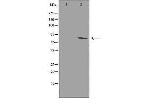 Western blot analysis of extracts of Mouse spleentissue lysate, using GRK1antibody. (GRK1 抗体  (N-Term))