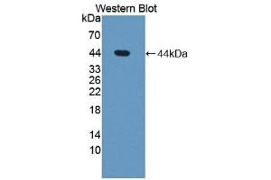 Detection of Recombinant STS, Human using Polyclonal Antibody to Steroid Sulfatase Isozyme S (STS) (STS 抗体  (AA 235-583))