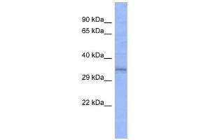 C20ORF111 antibody used at 1 ug/ml to detect target protein. (C20orf111 抗体  (N-Term))