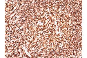 Immunohistochemistry (IHC) image for anti-Protein tyrosine Phosphatase, Receptor Type, C (PTPRC) antibody (ABIN6940460)