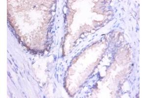 Immunohistochemistry of paraffin-embedded human spleen using MMP1 antibody at dilution of 1:100. (MMP1 抗体)