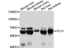 Western blot analysis of extracts of various cell lines, using PCK1 antibody (ABIN5971068) at 1/1000 dilution. (PCK1 抗体)