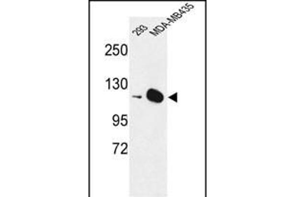 DIAPH2 抗体  (AA 870-899)