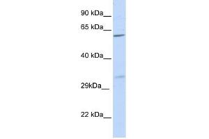 PRPS2 antibody used at 1 ug/ml to detect target protein. (PRPS2 抗体  (N-Term))