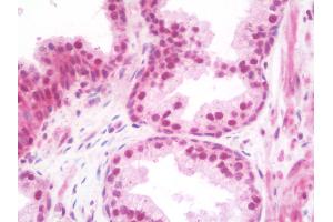 Anti-TRIM33 / TIF1-Gamma antibody IHC staining of human prostate. (TRIM33 抗体  (Internal Region))