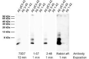 Detection of different synthetic Abeta species (dilution 1 : 1000). (Abeta-pE3 抗体)