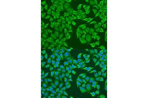 Immunofluorescence analysis of U2OS cells using IGF2BP3 antibody (ABIN6293021) at dilution of 1:100. (IGF2BP3 抗体)