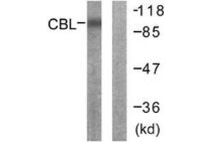 Western Blotting (WB) image for anti-Cas-Br-M (Murine) Ecotropic Retroviral Transforming Sequence (CBL) (AA 666-715) antibody (ABIN2888651) (CBL 抗体  (AA 666-715))
