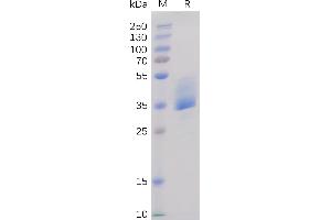 Human BAFF-R Protein, mFc Tag on SDS-PAGE under reducing condition. (TNFRSF13C Protein (AA 7-71) (mFc Tag))