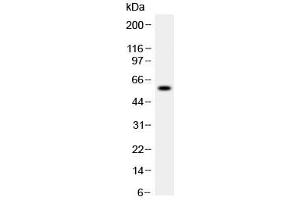 Western blot testing of human recombinant ADAMTS4 partial protein (0. (ADAMTS4 抗体  (AA 813-837))