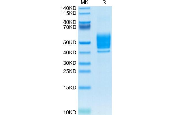 PSCA Protein (AA 21-95) (Fc Tag)