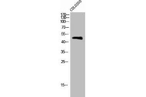 Western Blot analysis of COLO205 cells using Phospho-BLNK (Y96) Polyclonal Antibody (B-Cell Linker 抗体  (pTyr96))
