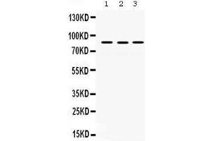 Western Blotting (WB) image for anti-MutL Homolog 1 (MLH1) (AA 722-756), (C-Term) antibody (ABIN3043404) (MLH1 抗体  (C-Term))