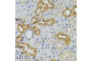 Immunohistochemistry of paraffin-embedded rat kidney using NAT8 antibody. (NAT8 抗体)