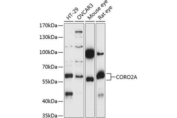 CORO2A 抗体  (AA 376-525)