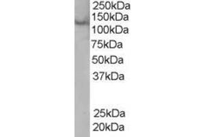 Western Blotting (WB) image for anti-Zinc Finger, FYVE Domain Containing 20 (ZFYVE20) (C-Term) antibody (ABIN2466174) (Rabenosyn 5 抗体  (C-Term))