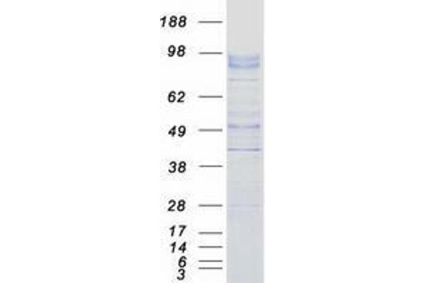 UNC5A Protein (Myc-DYKDDDDK Tag)