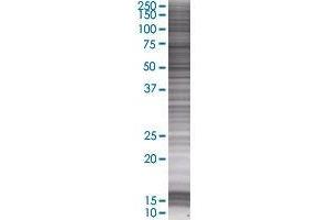 RPLP1 transfected lysate. (RPLP1 293T Cell Transient Overexpression Lysate(Denatured))