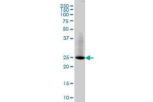 Western Blotting (WB) image for anti-RAB3B, Member RAS Oncogene Family (RAB3B) (AA 120-219) antibody (ABIN562557)