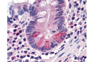 Anti-SLC15A1 antibody IHC of human small intestine, Paneth cells. (SLC15A1 抗体  (C-Term))